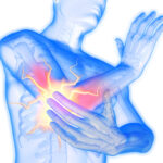 When a person gets tennis elbow, one or more of the tendons in their elbow becomes. Painful. Swollen and tight the pain occurs at the point where the tendons of the forearm muscle attach to the bone. Twisting movements, such as turning a door handle or opening the lid of a jar, are particularly painful. In other words your arm aches so much that you don’t want to move it Please DO NOT REACH FOR THE HEAT PAD’S, GEL OR ANY THING LIKE THAT. The first thing you need is our old friend ICE and yes you will have to rest the arm, in around three quarters of cases of tennis elbow, the dominant hand (the one that is used the most) is affected.