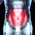 Symptoms of Prostate Cancer