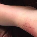 Accidents and Trauma Happen